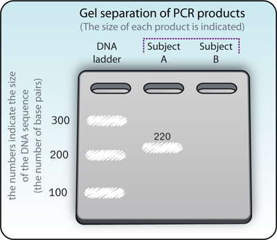 Figure 4: Gel separation of two PCR products from mutation-dependent amplification of two DNA samples, of subjects A and B